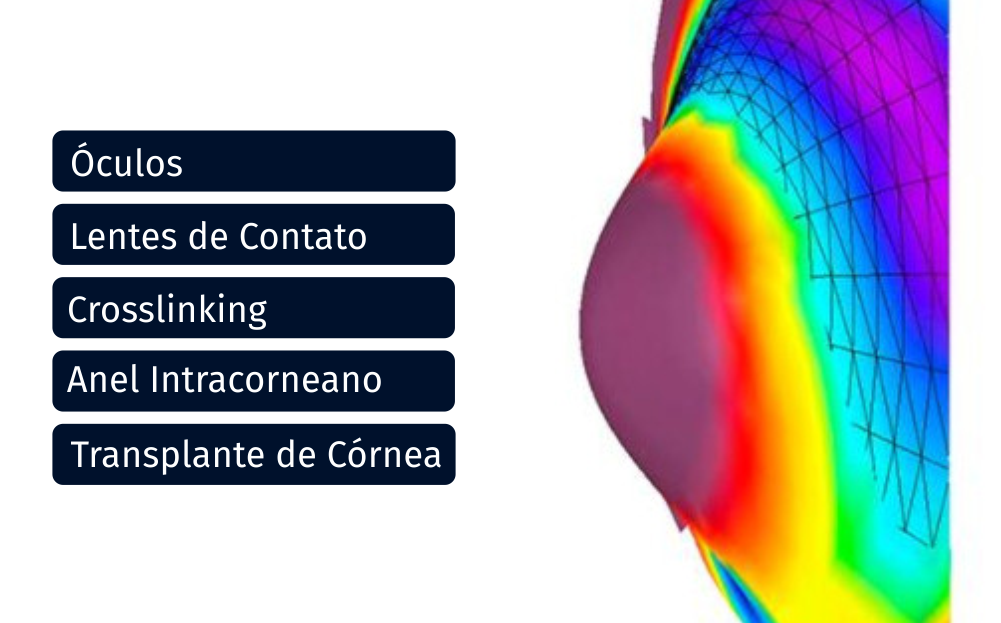 Quais os recursos para o tratamento do ceratocone?