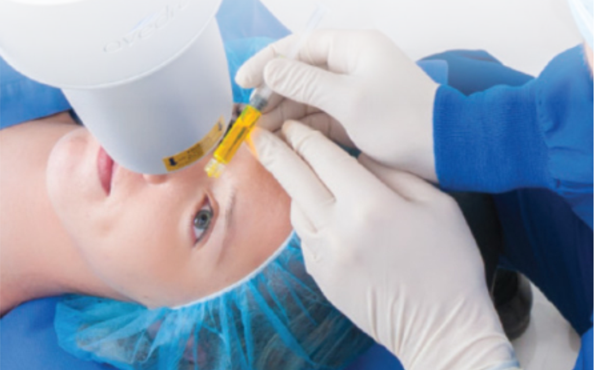 A importância do crosslinking para o tratamento de ceratocone